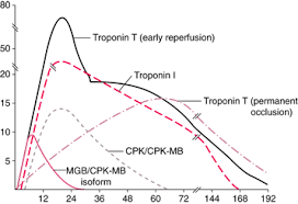 A Quick Review Of Troponin S Medical Lab Science Student