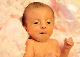 Edward's Syndrome Treatment Market is expected to reach USD