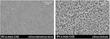 Lithium Disilicate - an overview | ScienceDirect Topics