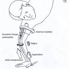 Image result for Pivot Shift Test