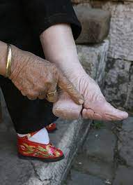 Horrific photographs show the centuries-old Chinese practice of foot  binding that breaks bones and agonisingly mutilates the toes into a 'lotus'  shape | The Sun