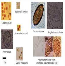 Principales Parasitos Intestinales Identificados Fuente Rayan Et Al Download Scientific Diagram