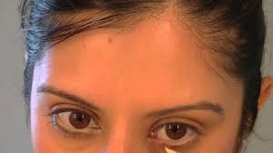 Different treatment strategies used to improve vision loss from. How To Put Makeup On A Lazy Eye Saubhaya Makeup