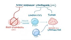 B lymphocytes (b cells) or t lymphocytes (t cells). Non Hodgkin Lymphoma Osmosis