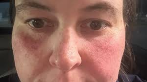 Fundraiser by Sheri Ware : Help Sheri Fix Her Car and Health