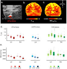 (physics) the characteristic time for a system to reach an equilibrium condition after a disturbance. Apparent Thinning Of Visual Cortex During Childhood Is Associated With Myelination Not Pruning Biorxiv
