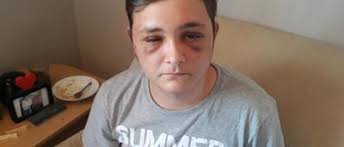 Séquestré et torturé à Fosses, Dorian (19) nous raconte: vidéo!