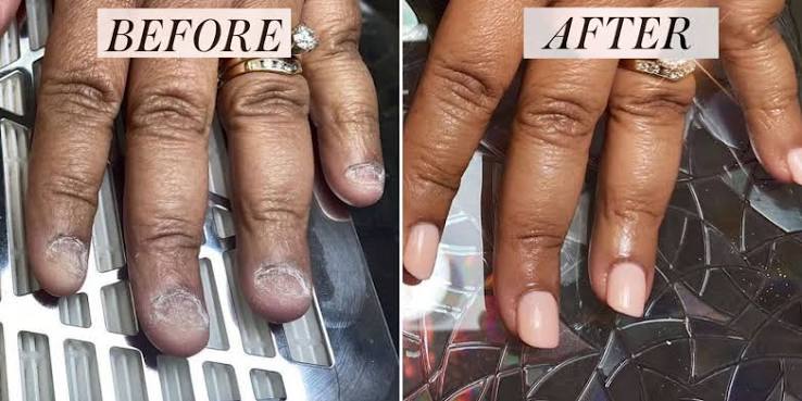Healthy feet care