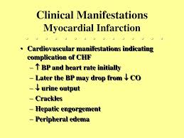 Ppt Myocardial Infarction Powerpoint Presentation Free Download Id 5496542