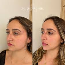 All we have is NOW 📝