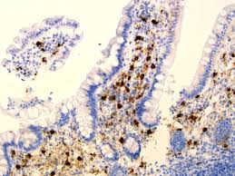 Mast Cells In Bone Marrow Mast Cell Medical Research Cell