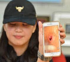 The therapist will come to your hotel in kuchai lama.our team will be there always. 20 People Suffer Contagious Bacterial Infection After Visiting Massage Parlour In Kuchai Lama World Of Buzz