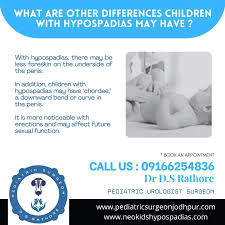 Image result for Chordee