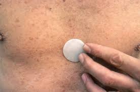 Image result for Nitroglycerin Patch