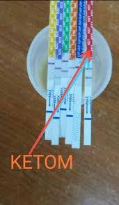 One of the main problems with urine testing for ketones is that there is a delay in the urine becoming positive to ketones. Awas Kini Strip Untuk Penawar Ketum Haromain Facebook