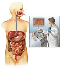 Once alert enough, you will be given something light to eat and drink. Asian Institute Of Gastroenterology