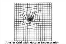 Download Your Free Amsler Grid Specialty Eye Institute