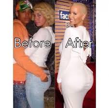 Before And After Photos Of Amber Rose Best Photo Celebrity Plastic Surgery Cool Outfits Amber Rose