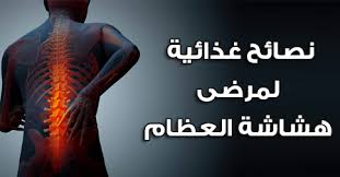 10 نصائح غذائية لمرضى هشاشة العظام ثقف نفسك