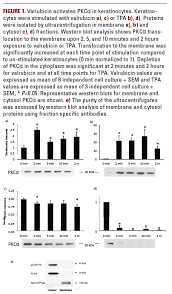 Image result for Valrubicin