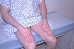 Image result for Rapid Alternating Movements