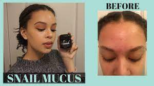 This cream contains 92% snail slime (the same amount, by the way, as the generally well received mizon snail repair all in one cream). I Used Snail Cream On My Face For 2 Weeks Mizon Black Snail Cream Review Youtube