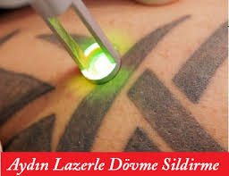 Aydin Dovme Sildirme Fiyati Lazer Epilasyonu Lazer Epilasyon Fiyatlari Merkezleri Ve Cihazlari