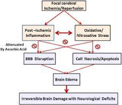 Therapeutic Treatment With Vitamin C Reduces Focal Cerebral Ischemia Induced Brain Infarction In Rats By Attenuating Disruptions Of Blood Brain Barrier And Cerebral Neuronal Apoptosis Sciencedirect