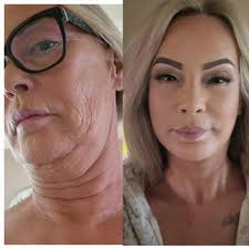 Can't decide which surgeon so wondering if anyone has been with these dr's  Arman AK or Kerem Sami Kaya. Any info to help me make my mind up 🫣