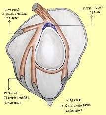 The glenoid labrum (glenoid ligament) is a fibrocartilaginous rim attached around the margin of the glenoid cavity in the shoulder blade. Superior Labrum Anterior To Posterior Slap Lesions Of The Shoulder Orthopaedics And Trauma