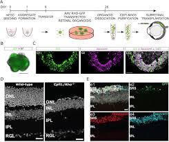 Metal kitchen rack w \/metal rods vs cones function eyes wide. Transplantation Of Photoreceptors Into The Degenerative Retina Current State And Future Perspectives Sciencedirect