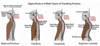 Pin On Neck Pain