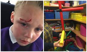 Boy banned from playgroup after mum complained about accident that left him  'scarred for life'