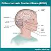 Many children with a brain tumor experience headaches before their diagnosis. 1