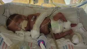 Fundraiser by Moni Salcido : Fighting NEC with Benjamin