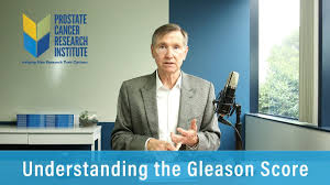 The earlier the detection of prostate cancer, the better the patient's chance of survival is. Understanding The Gleason Score Prostate Cancer Staging Guide Youtube