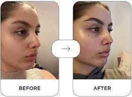 Kyla Klear Clay Mask 100 g : Amazon.com.au: Beauty