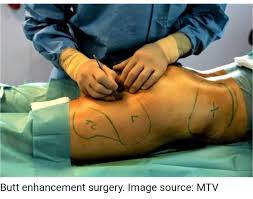 zcinternational: Elena Jessica, a young Nigerian woman, has died following  a Brazilian Butt Lift (BBL) she underwent at Cynosure Aesthetic Plastic  Surgery in Lagos. Jessica had initially been denied the procedure at