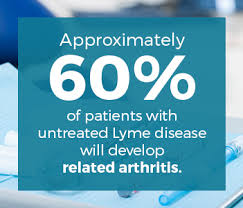 There are two basic types of arthritis pain amplification syndrome and fibromyalgia cause persistent pain without any visible abnormalities. What Is Lyme Disease How Can It Cause Joint Pain Oip