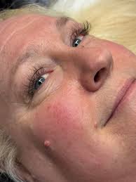 Any techs in Bremerton, WA? Or close by?