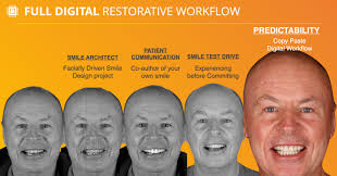 How do we use 3D facial design for your smile makeover? Case Study