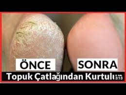 Ovakent Panosundaki Pin