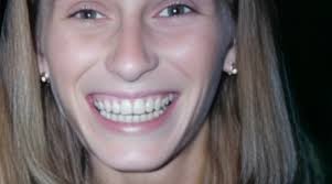 Yolanda Bindics Disappearance and Death in Jamestown New York