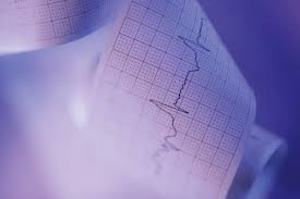Langzeit Ekg Herz Unter Dauerbeobachtung