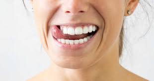 Ich hatte auch mal vor, ein bleaching zu machen, allerdings hat mir sogar der zahnarzt davon abgeraten, weil es die zähne beschädigen könnte.mir wurde dann eine. Weisse Zahne Hausmittel 9 Naturlichen Zahnaufheller We Go Wild