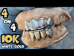 Maybe you would like to learn more about one of these? Real 10k Solid White Gold Custom Grillz Set Four On 4 Teeth Diamond Dust Grills Youtube