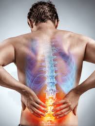 non surgical back pain management