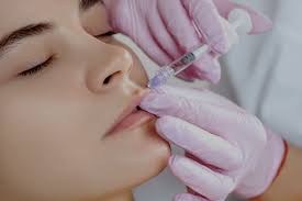 Dermal Fillers