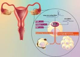 Cancer And Sox Proteins New Insight Into Their Role In Ovarian Cancer Progression Inhibition Sciencedirect