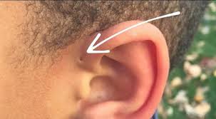 What does this little mark on the ear mean? We explain the meaning of the  hole in the ear
